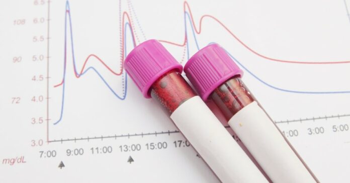 Vials of blood over a blood sugar chart