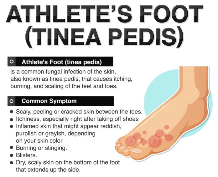 Athlete's foot (tinea pedis) and Diabetes