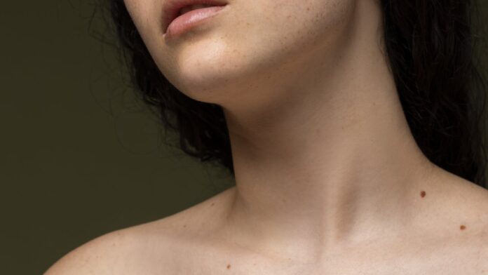 Is it a mole or a skin tag: Know the similarities and differences