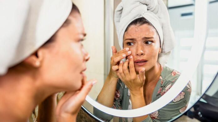 Pallor: 11 reasons why your skin is looking pale all of a sudden!