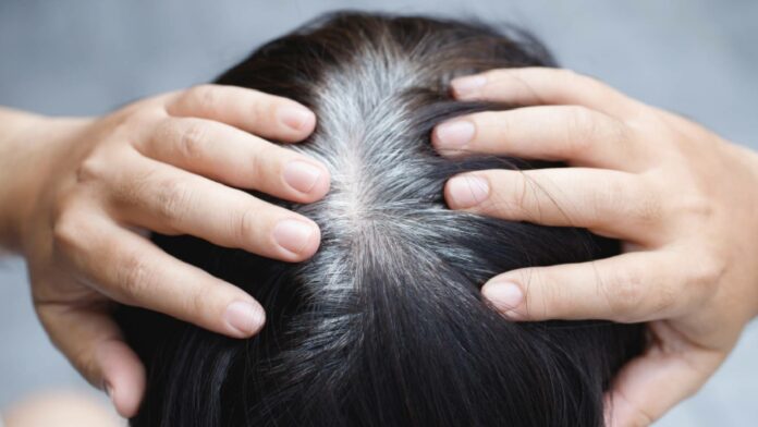 All about premature grey hair, why it happens and can you reverse it?