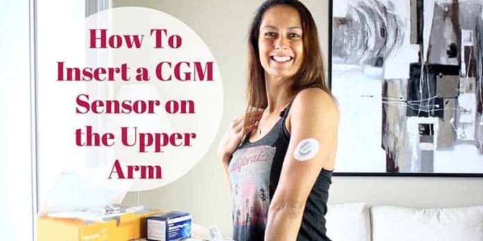 How to Insert a Dexcom CGM in the Upper Arm (Without Help)