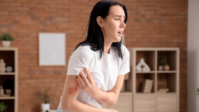 Get easily bruised? It may be due to haemophilia B