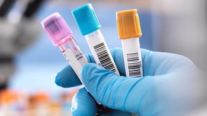 How Is Hereditary Angioedema (HAE) Diagnosed?