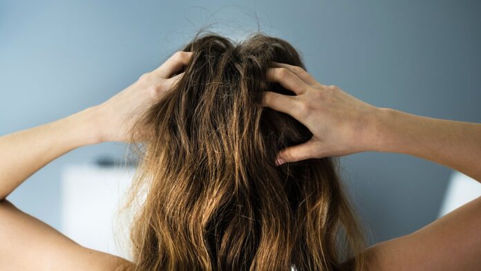 20 Remedies for Scalp Psoriasis Itch and Irritation