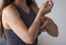 Winter rash or eczema? A dermatologist explains the difference and when to seek help How colloidal oatmeal and ceramides can beat eczema? A dermatologist answers