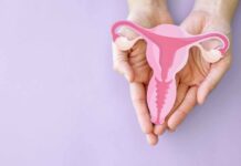 What every parent must know about teenage PCOS What every parent must know about teenage PCOS