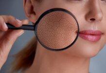 Winter skincare tips: Dermat says avoid long hot showers, apply richer creams Winter skincare tips: Dermat says avoid long hot showers, apply richer creams