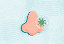 What Is a Sinus Infection? What Is a Sinus Infection?